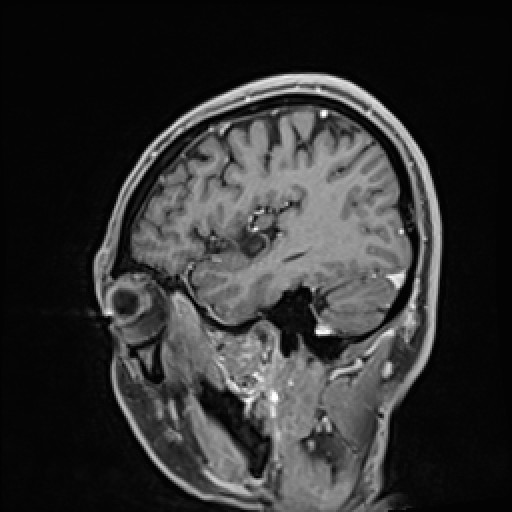 Click on the Serie image to view the images of VILLANUEVA, WILLIAM A.